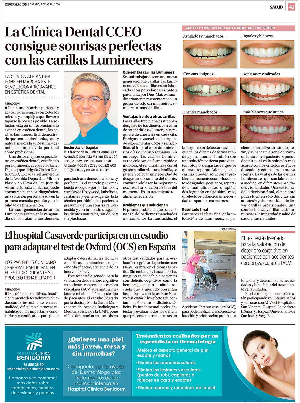 Noticia de Información de Alicante sobre la Clínica Dental CCEO y las carillas Lumineers 2